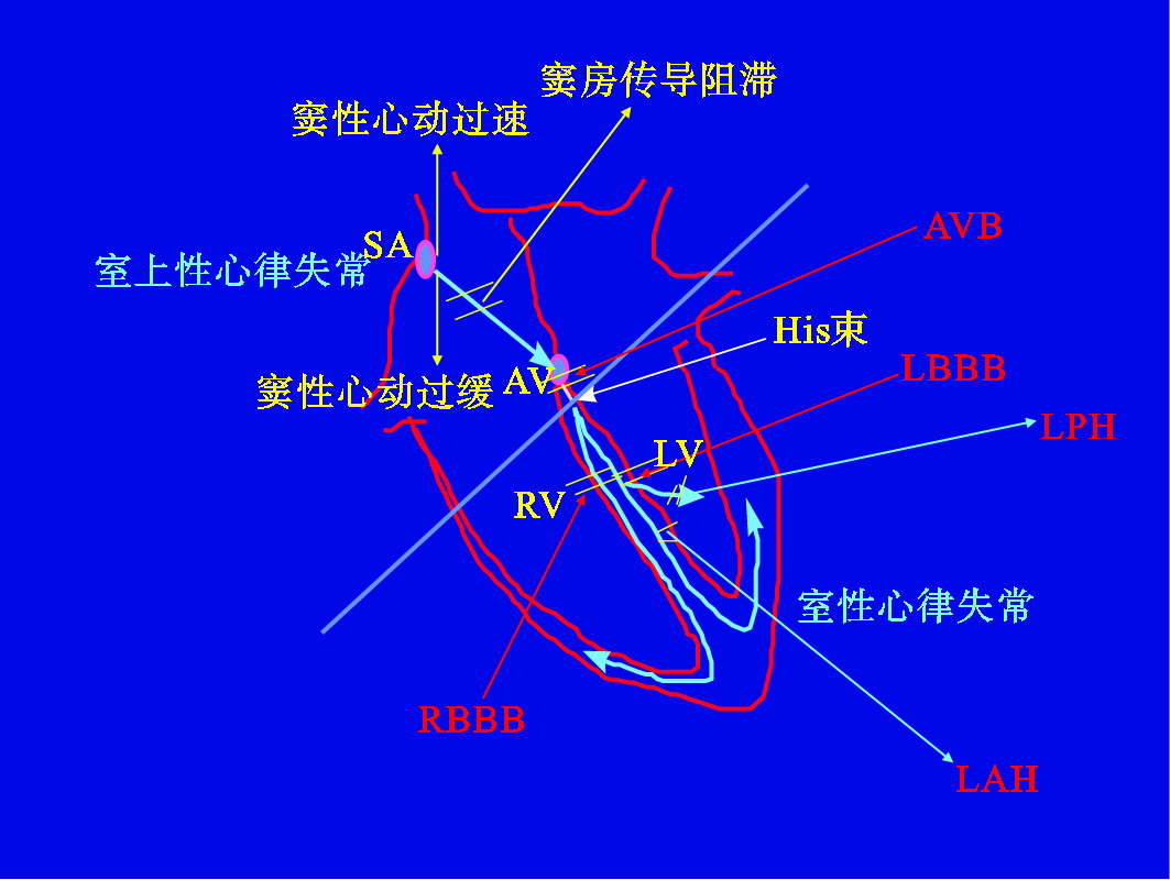 二、心律失常的發(fā)生機制