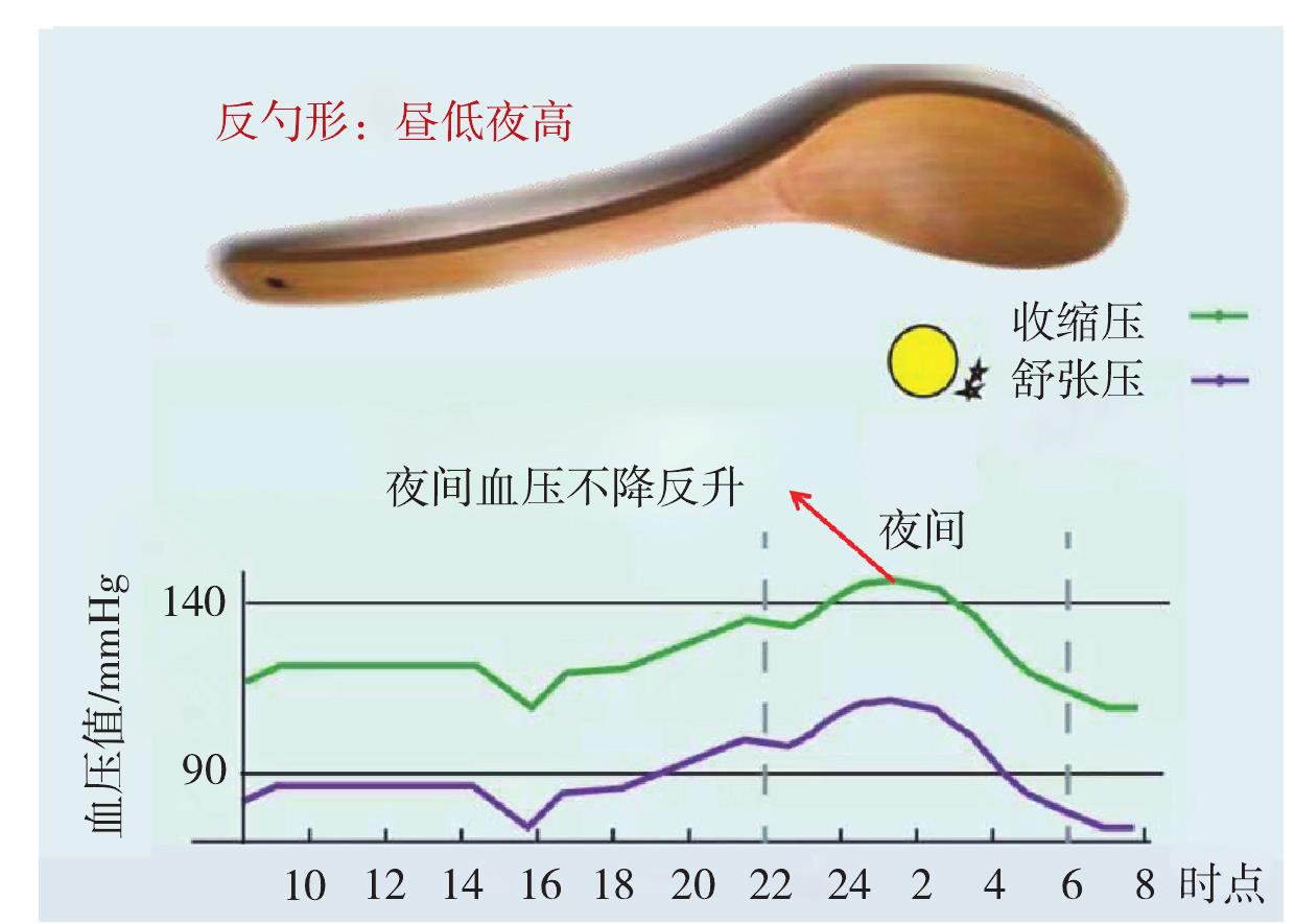 什么是反勺形血壓?