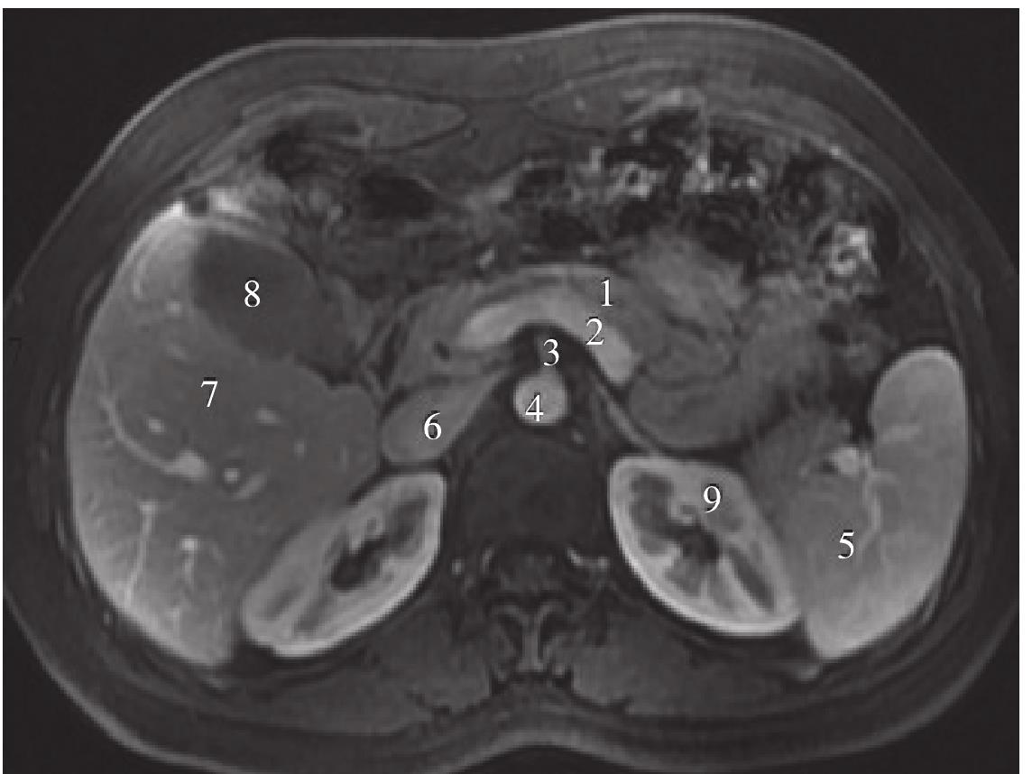 第三节 腹部实质性脏器MRI解剖