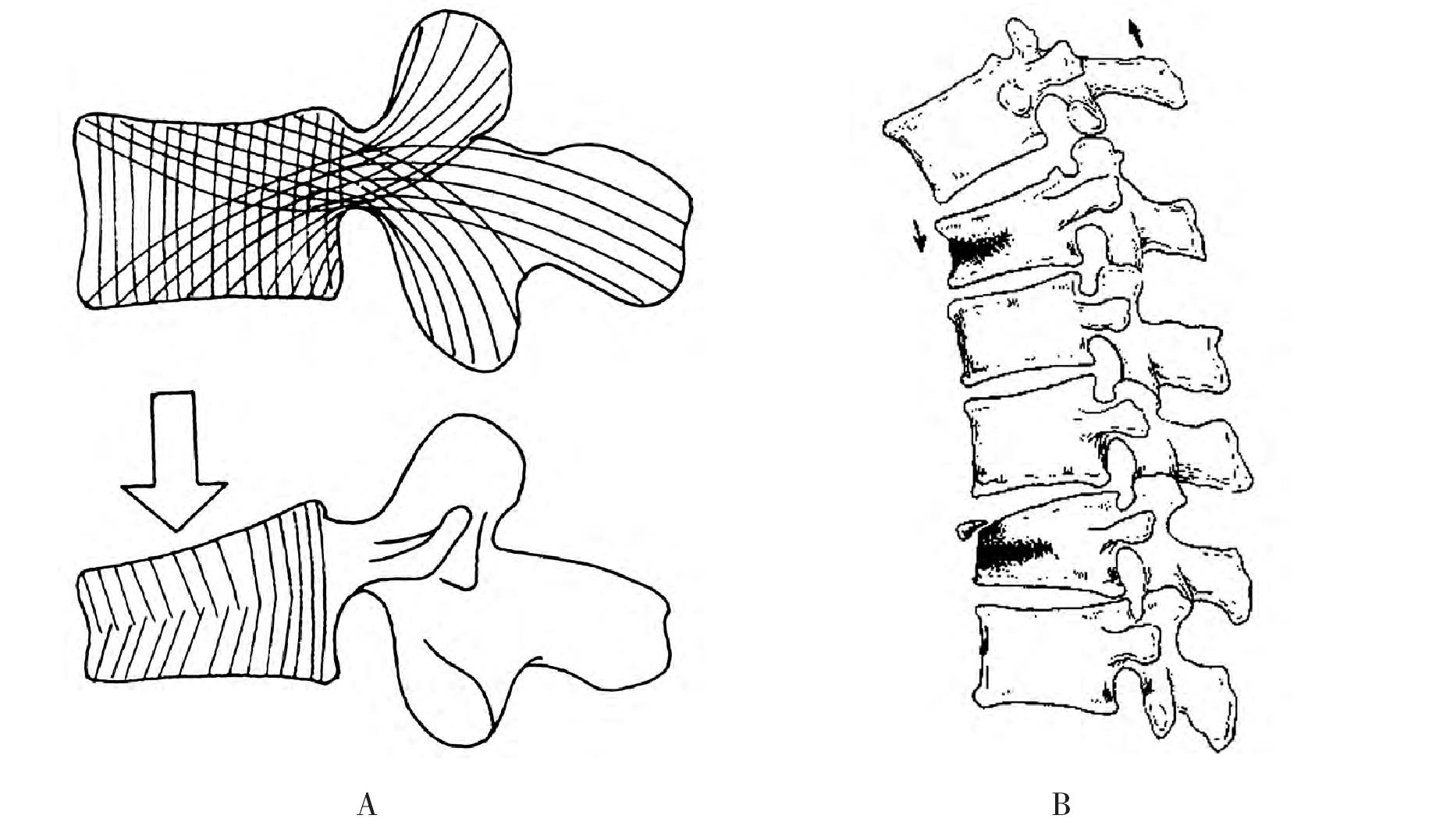 二、椎体的应用解剖