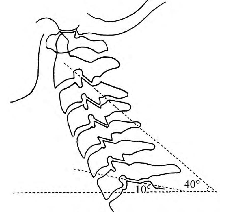 四、关节突关节的应用解剖