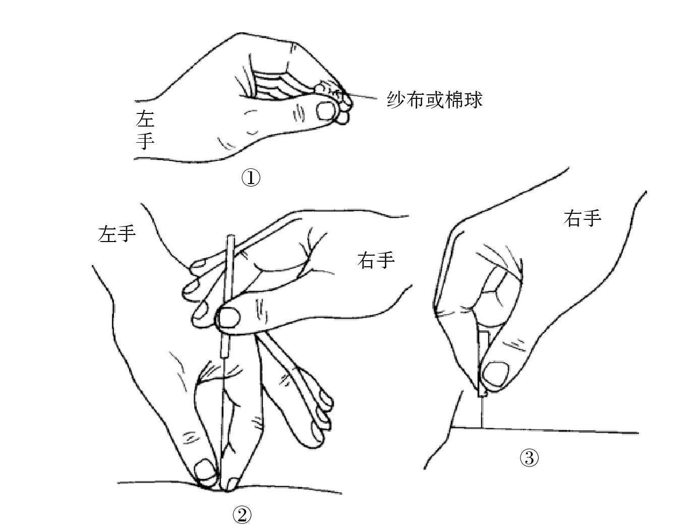 十、進針程序