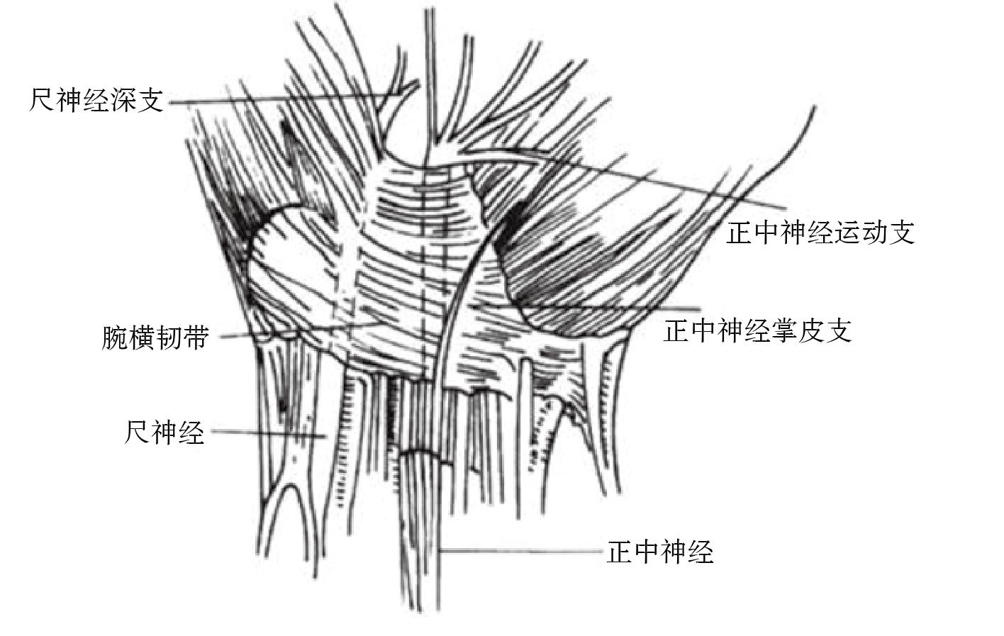第二節(jié) 腕管綜合征