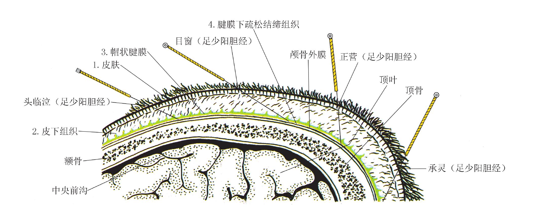 九、頭臨泣GB 15