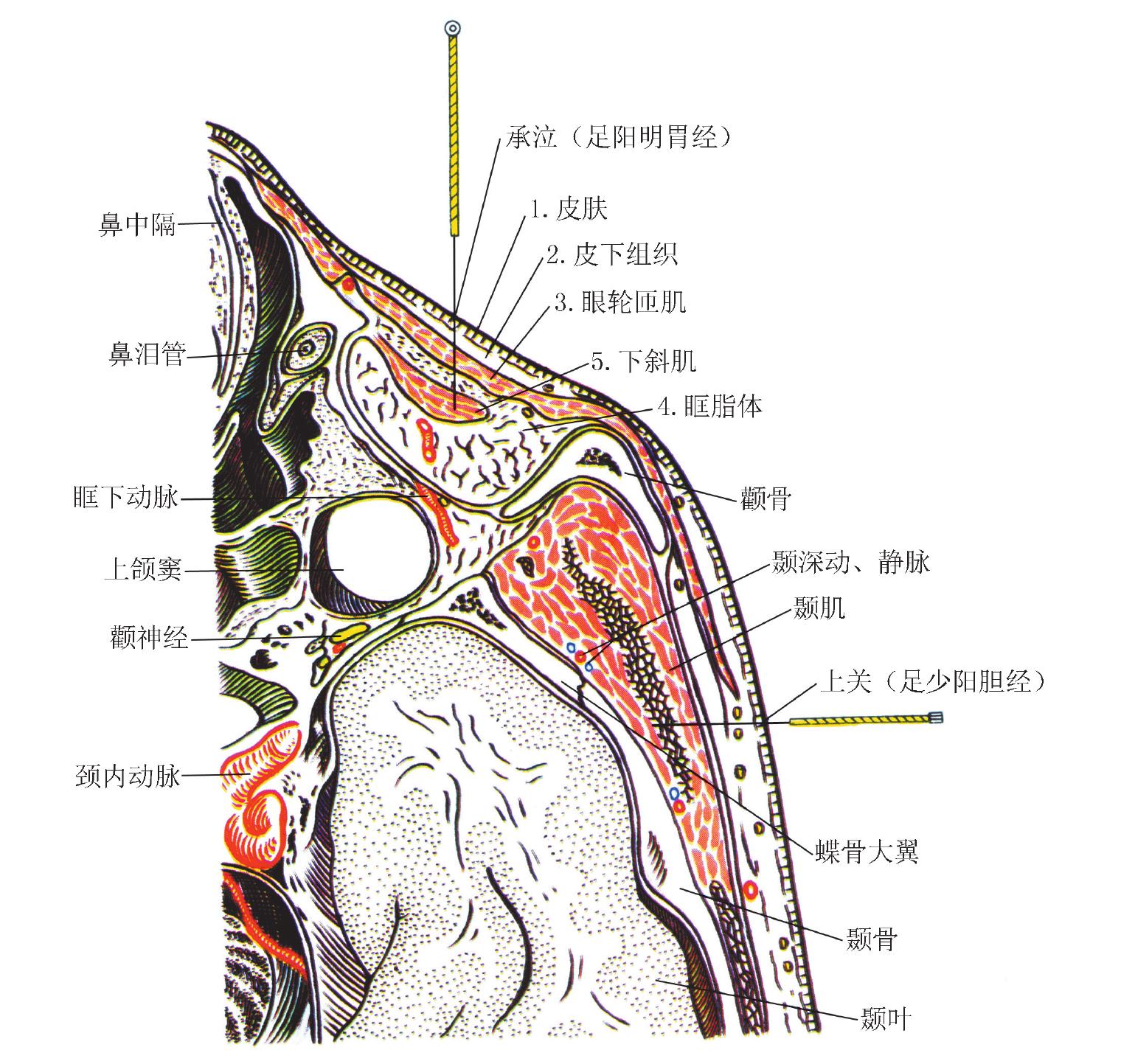 十三、承泣ST 1