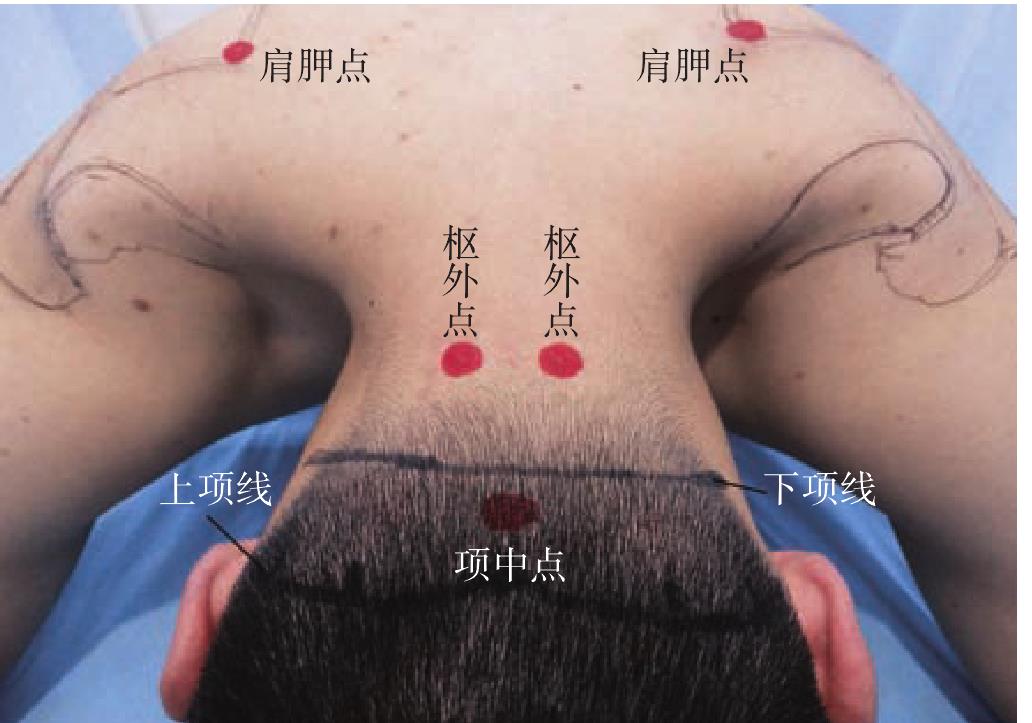 A.7 項(xiàng)五針