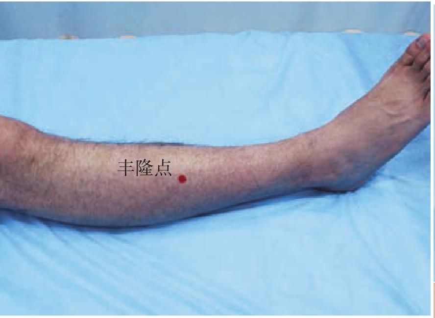 A.27 痛風(fēng)五針