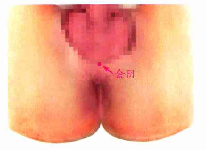 會陰