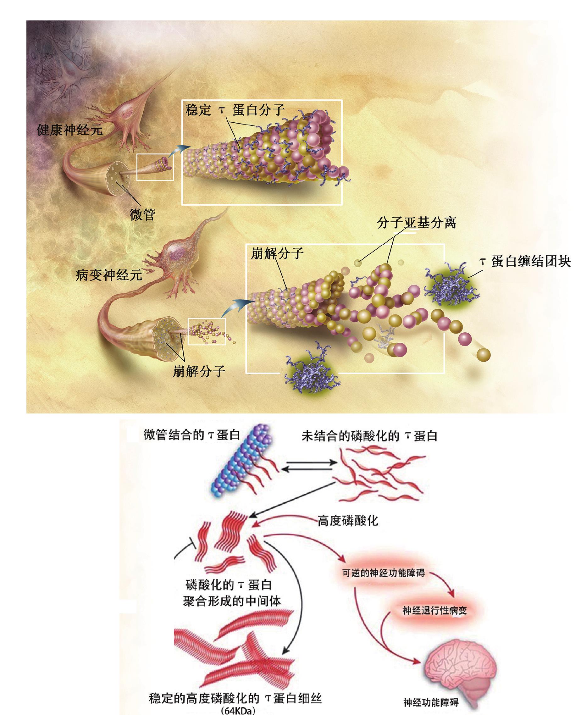 二、τ蛋白假說