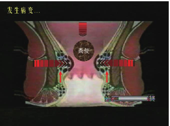 一、病因病理