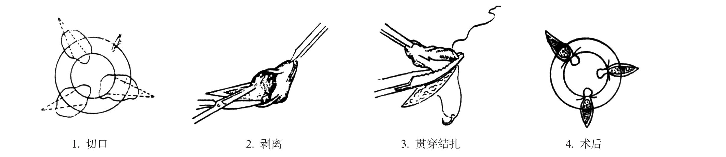 四、治療