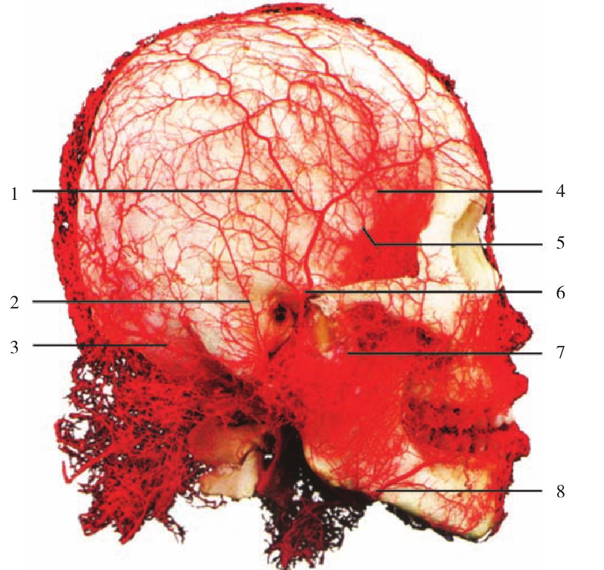 图1-10  头颈部动脉铸型(侧面观2)