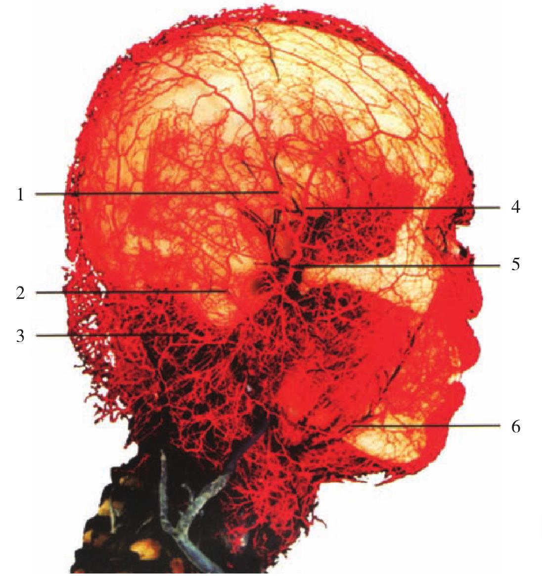 图1-9  头颈部动脉铸型(侧面观1)