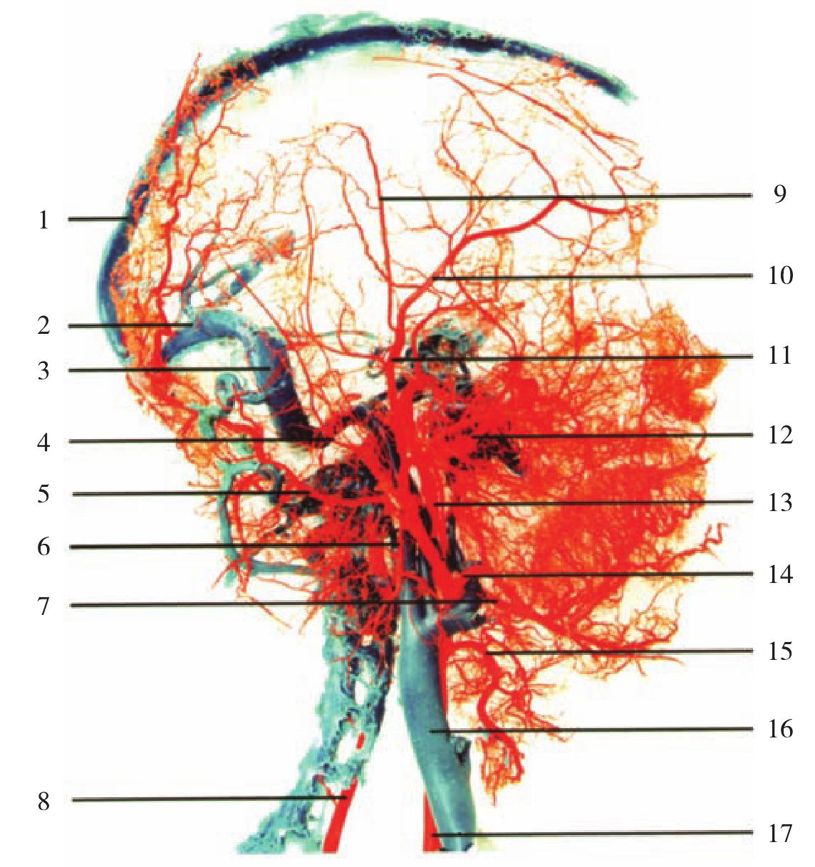 图1-11  头颈部动脉铸型(侧面观3)