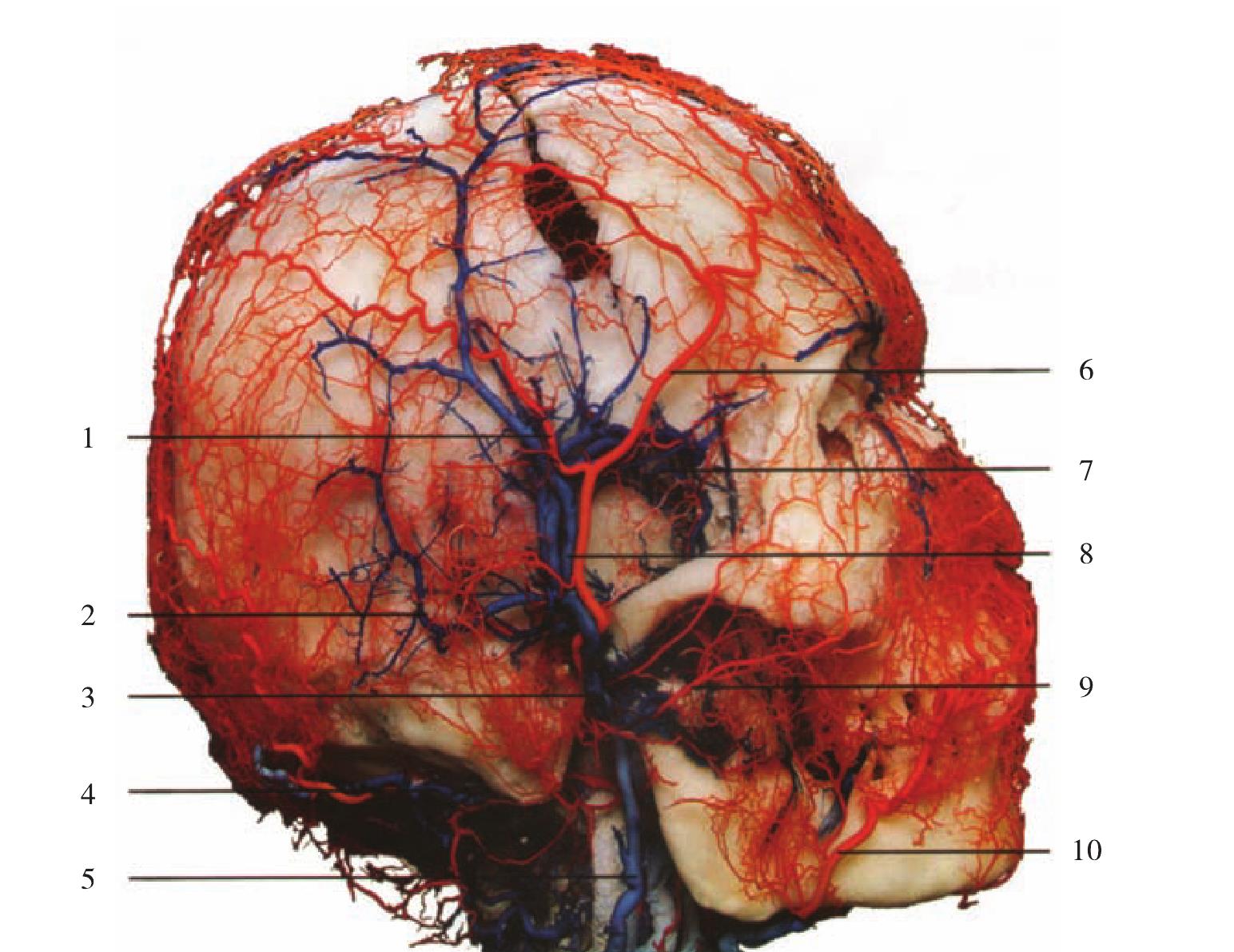 大脑动静脉分布示意图-人体解剖图,_医学图库