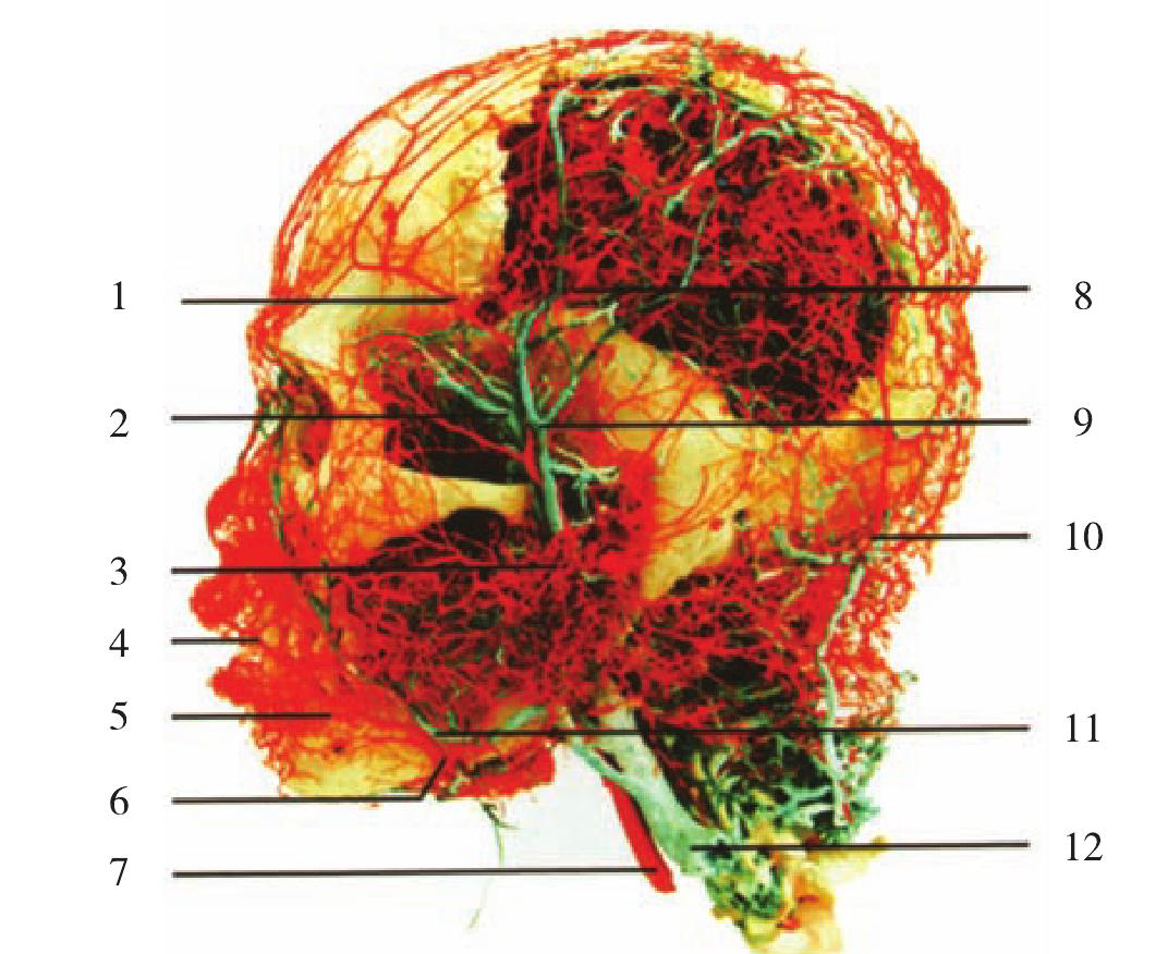 图1-16  头面部动、静脉铸型(侧面观3)