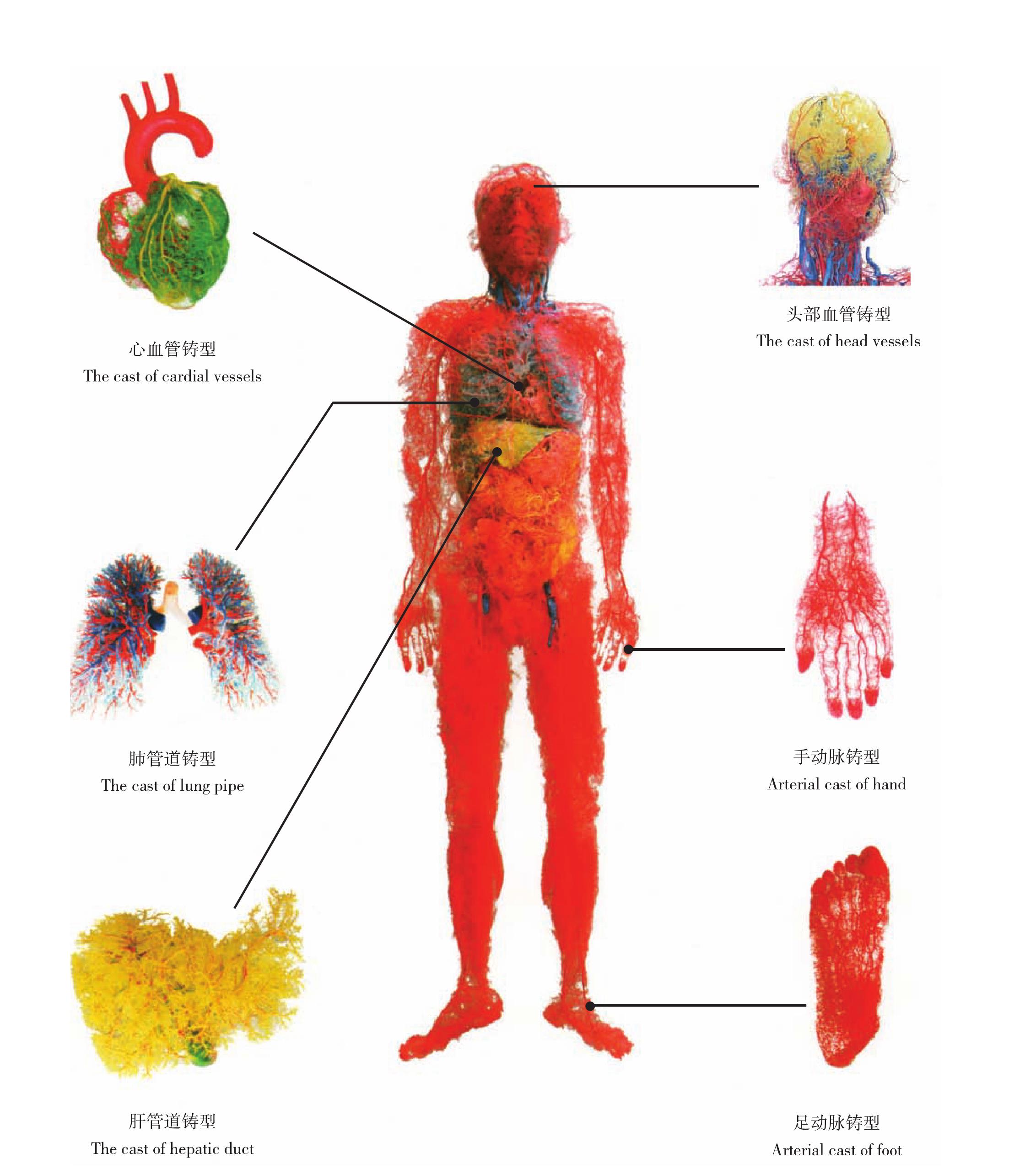 图1-2  全身血管铸型(2)