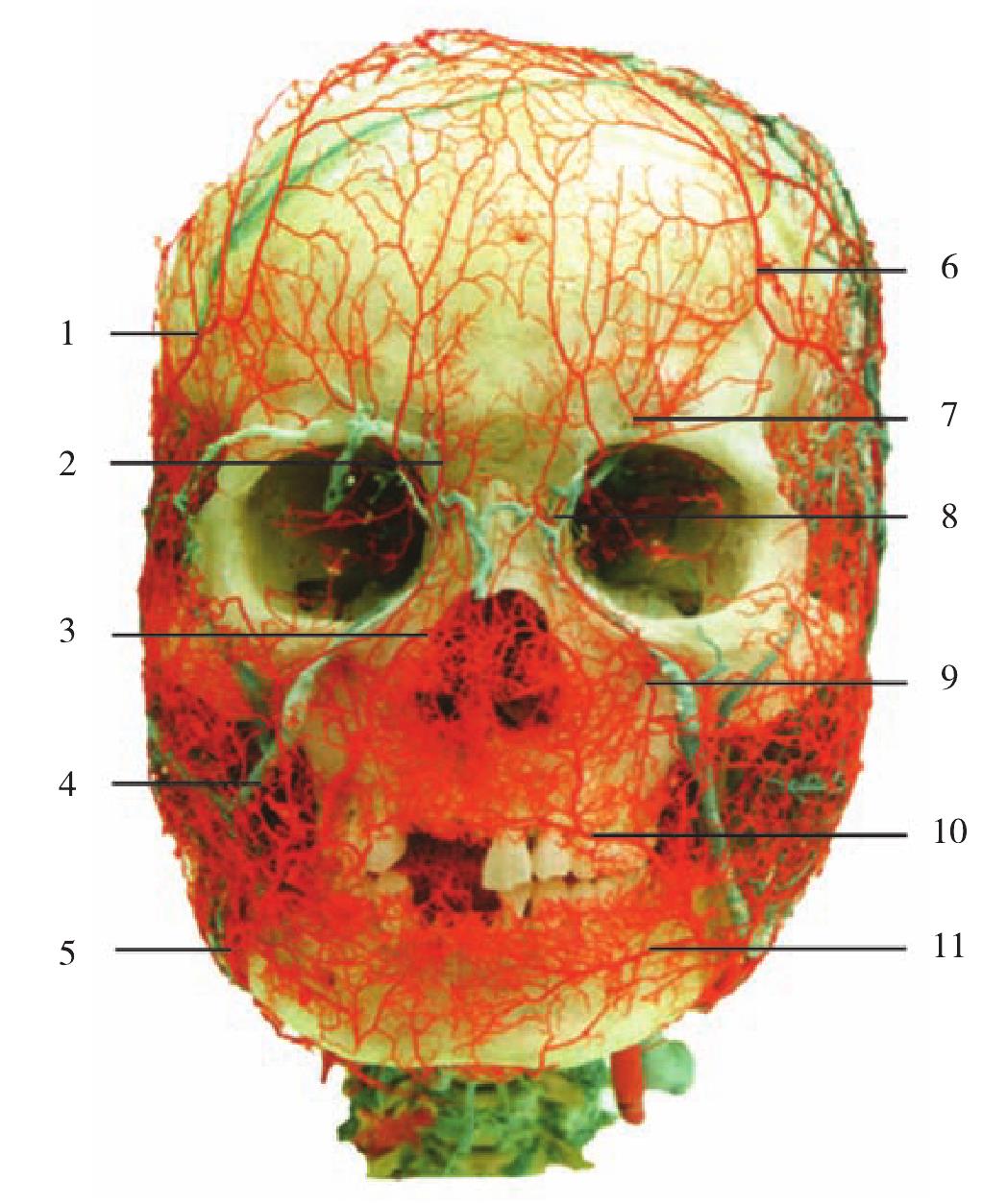 图1-6  头颈部动脉铸型(前面观2)