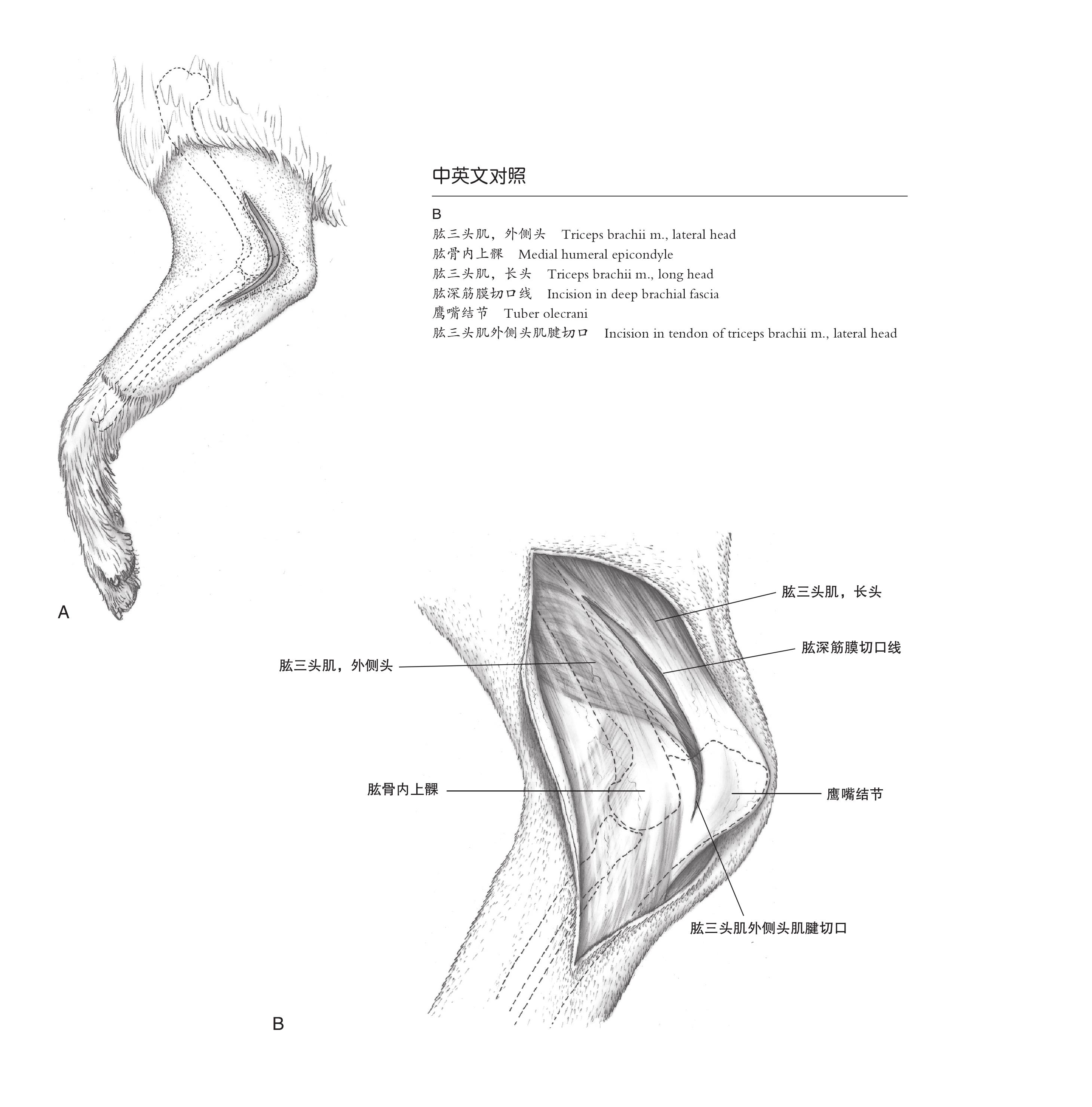 5.7 犬肱骨髁和上髁外侧手术入路