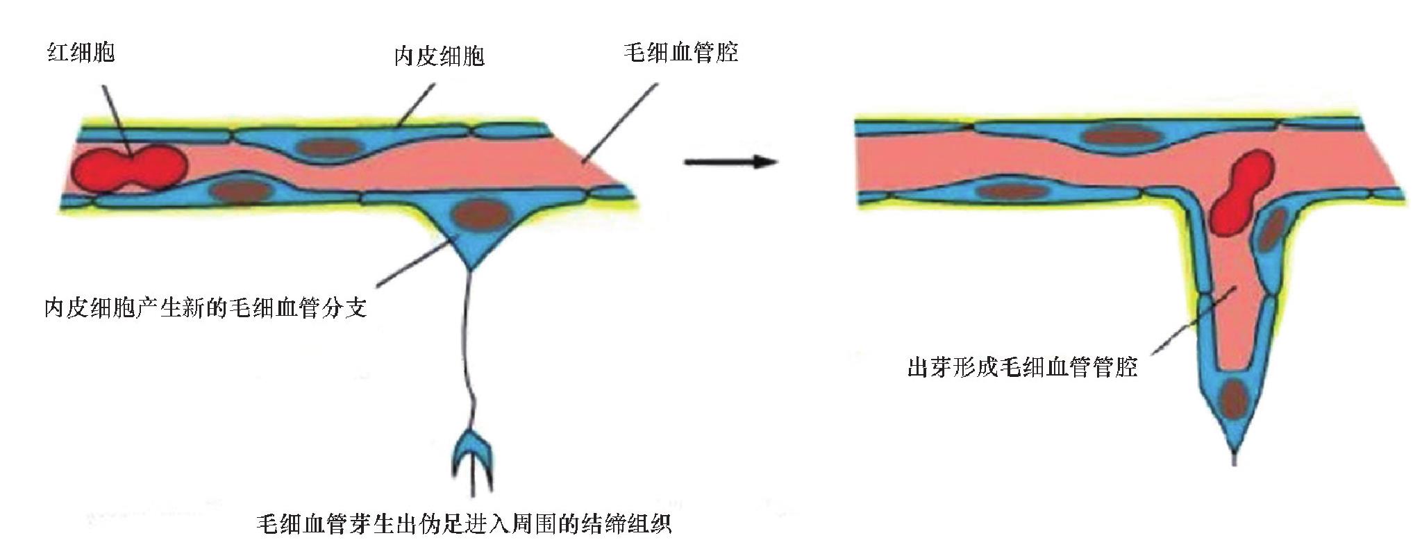 一、戰(zhàn)創(chuàng)傷愈合的基本病理生理過(guò)程