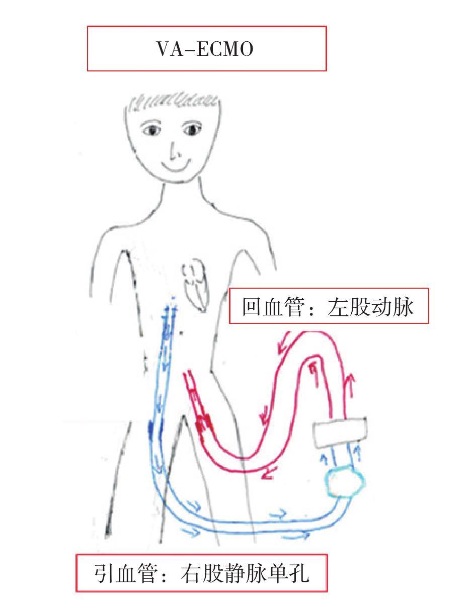 附件2 置管方案(圖2-36)