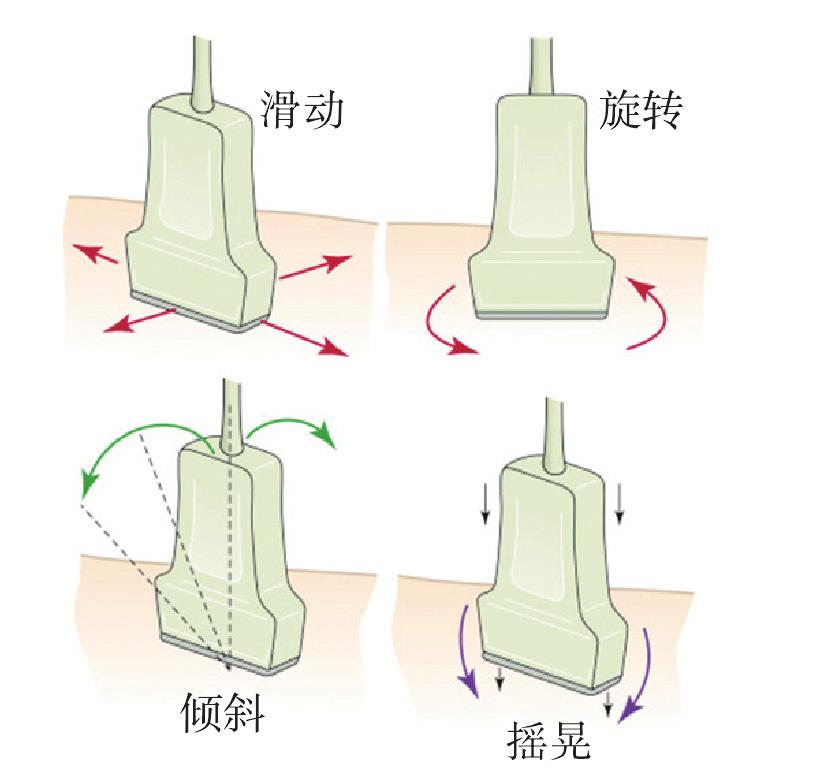 床旁超聲機(jī)使用指引