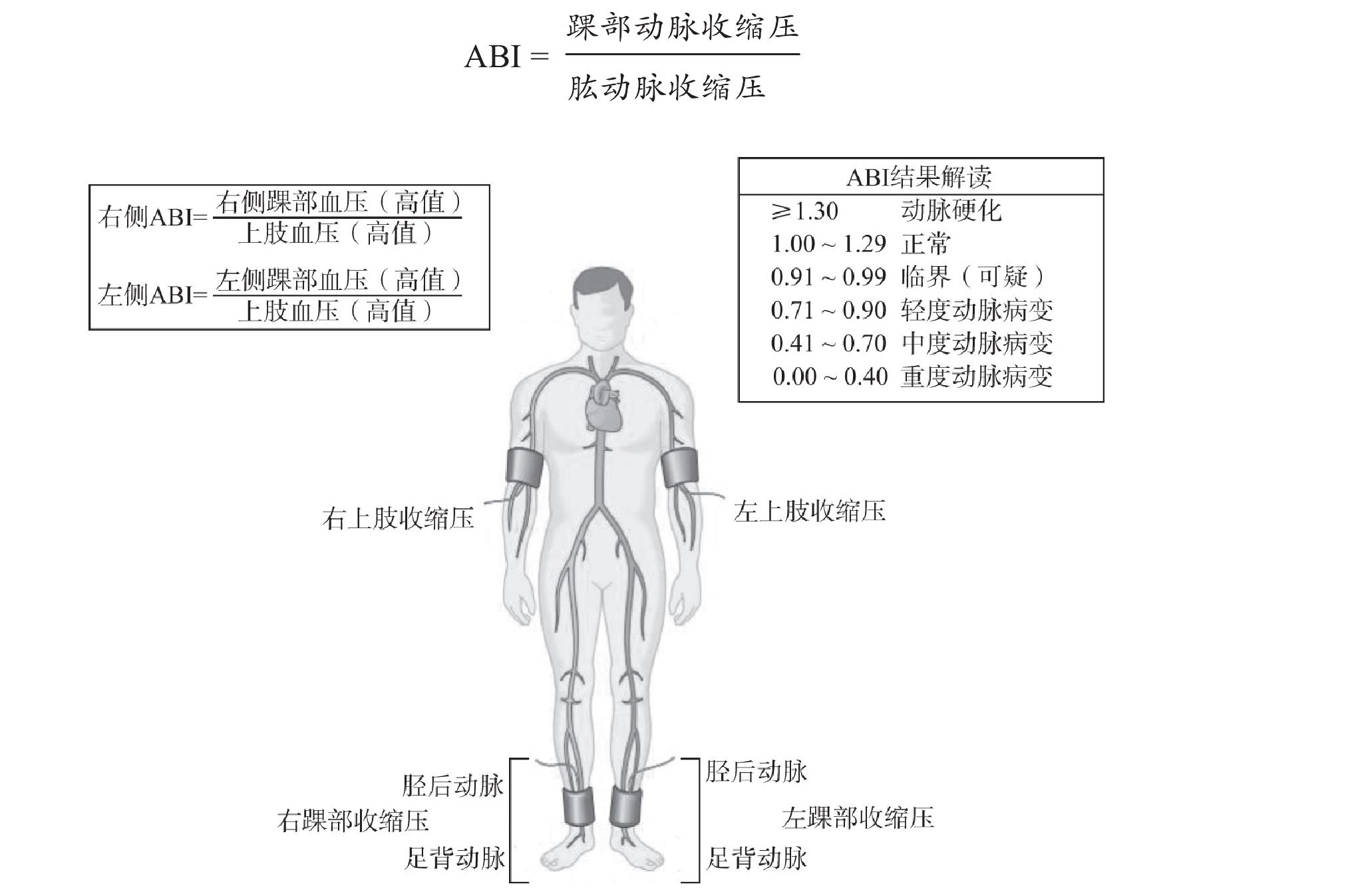 第二章 糖尿病周围血管病变的筛查与评估