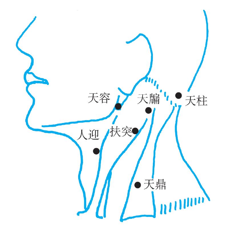 二、頭痛