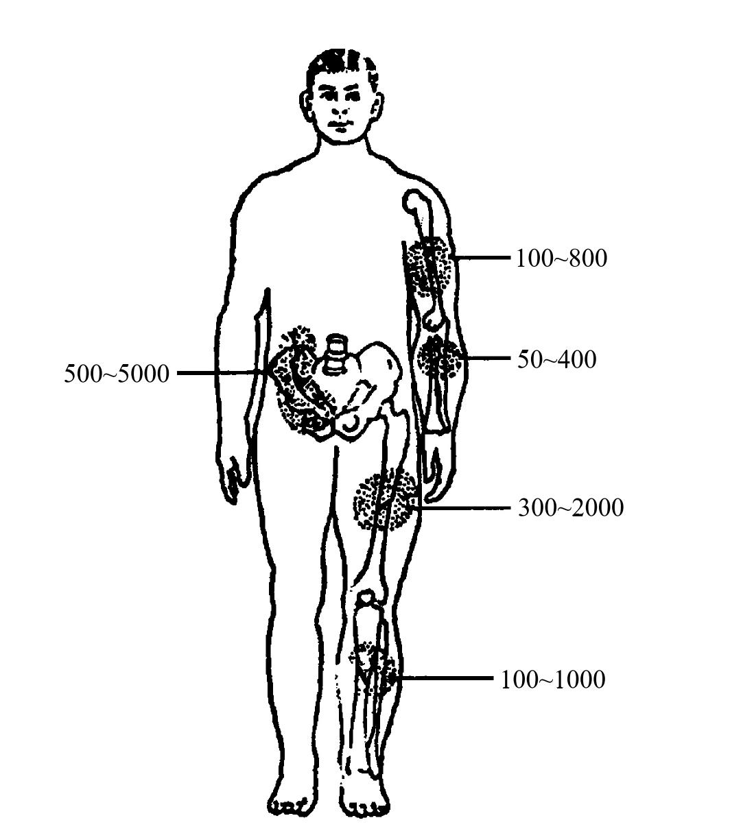 3.骨折有哪些臨床表現(xiàn)?