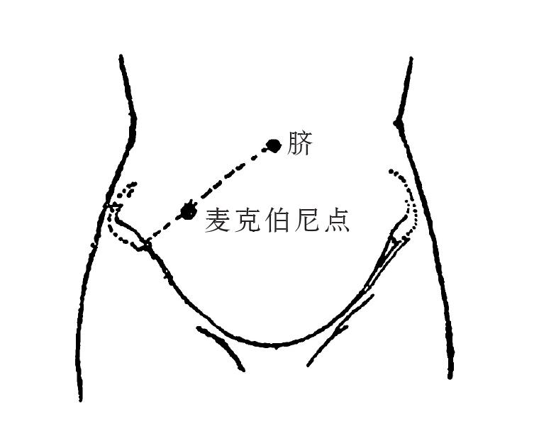 4.不同腹部内脏器官疼痛有何特点