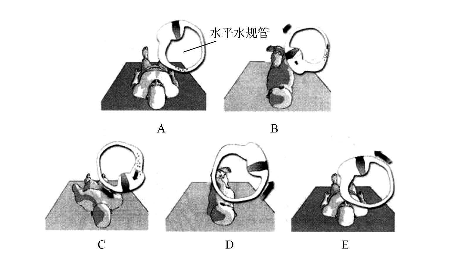 【治療】