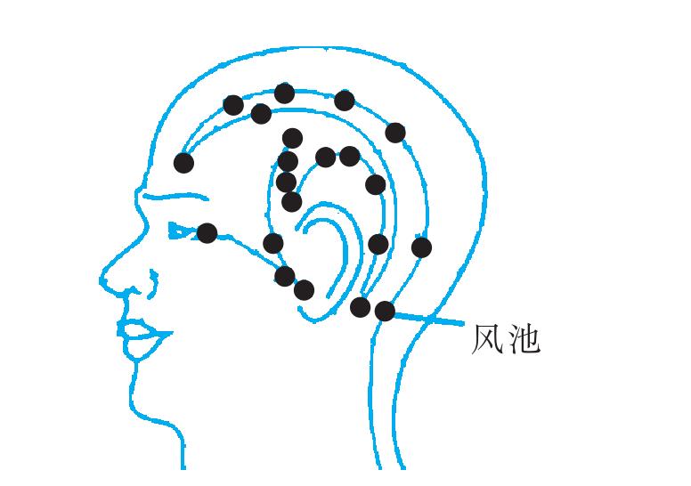 20.風(fēng)池