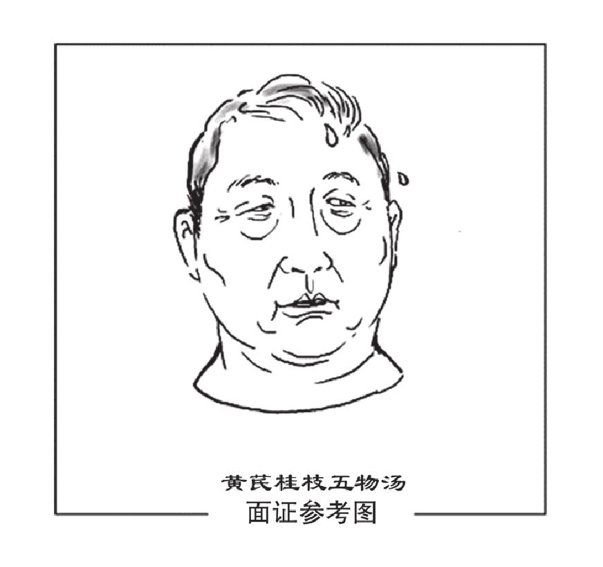 黃芪桂枝五物湯