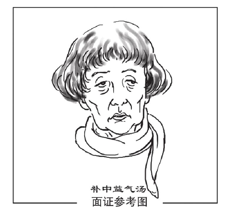 補中益氣湯