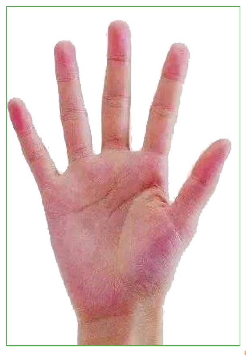 紫红色手掌