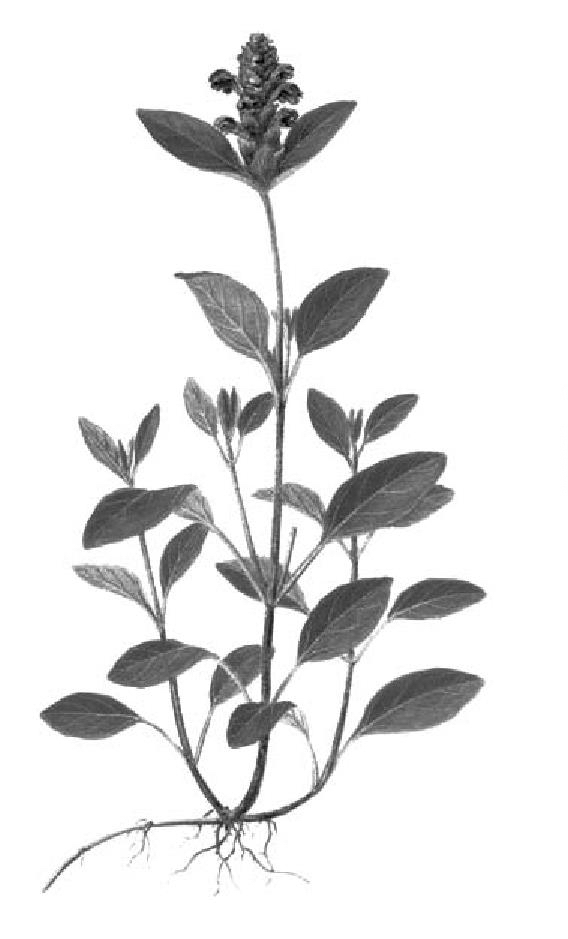 33.慢性化膿性中耳炎