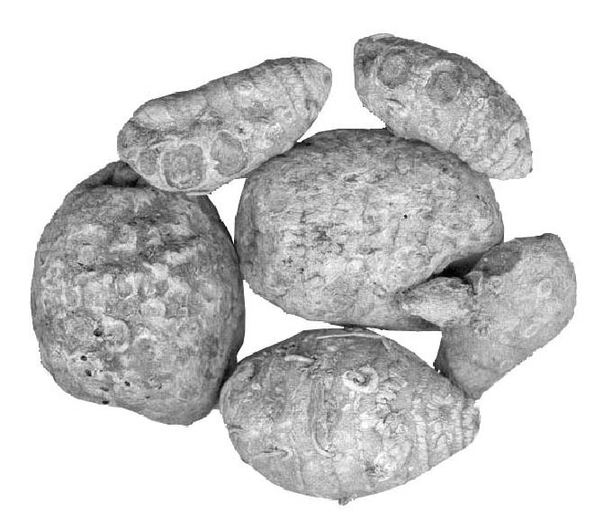 14.結(jié)腸癌