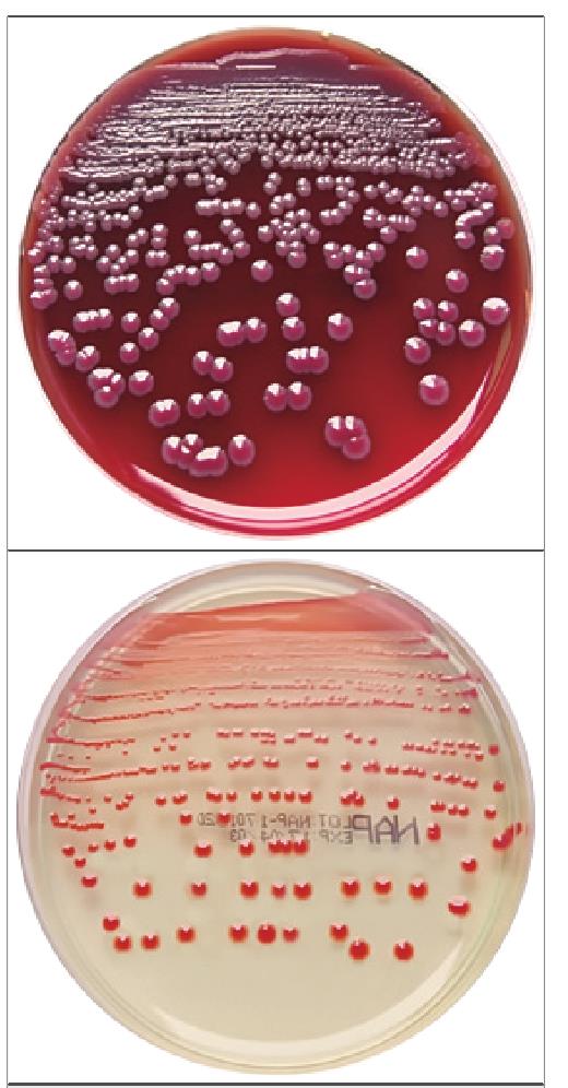 五种产色素细菌的菌落特征