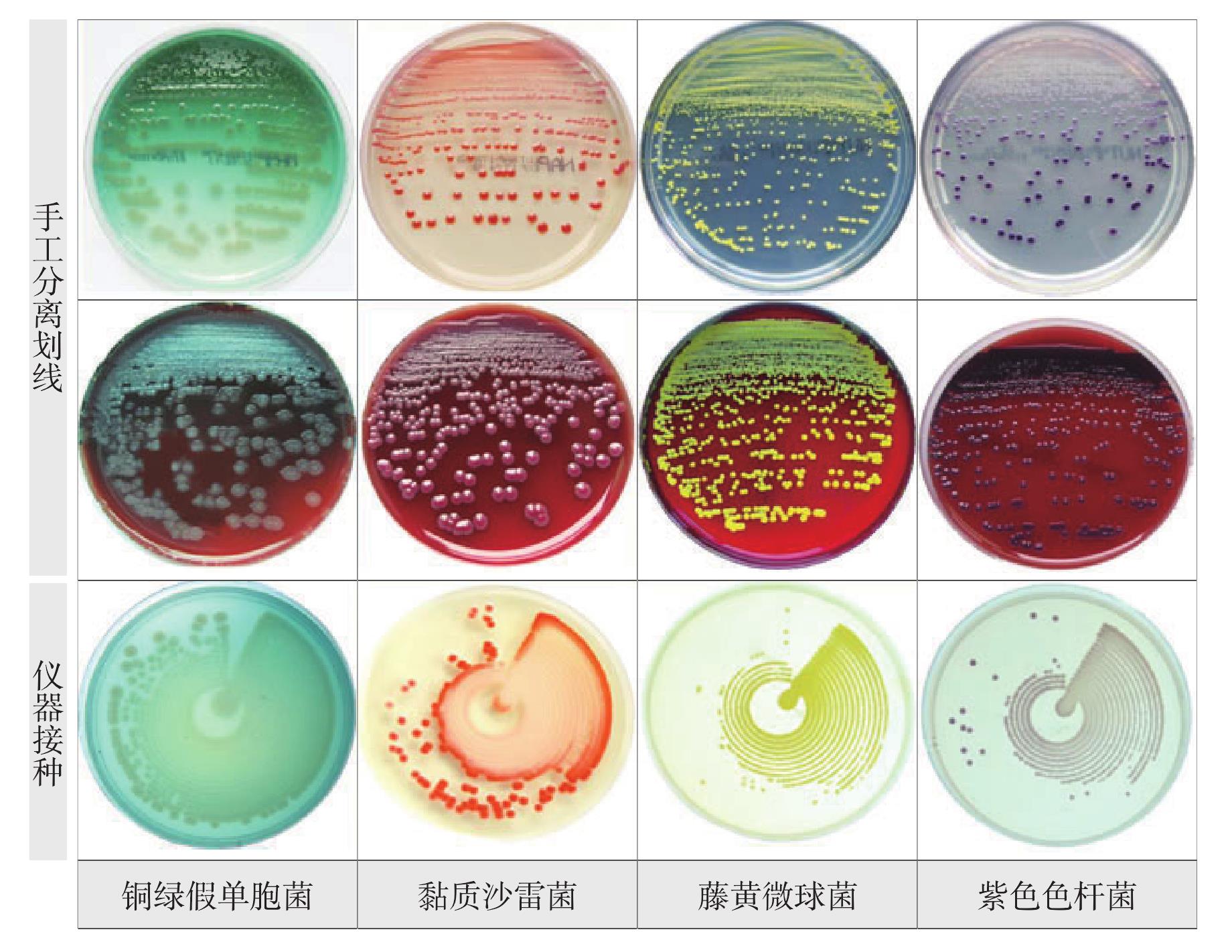 細(xì)菌手工分離劃線與全自動(dòng)微生物接種儀接種菌落圖