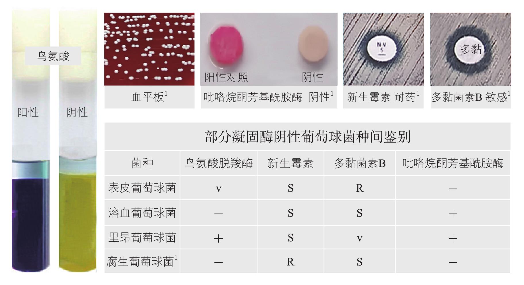 腐生葡萄球菌腐生亞種鑒定
