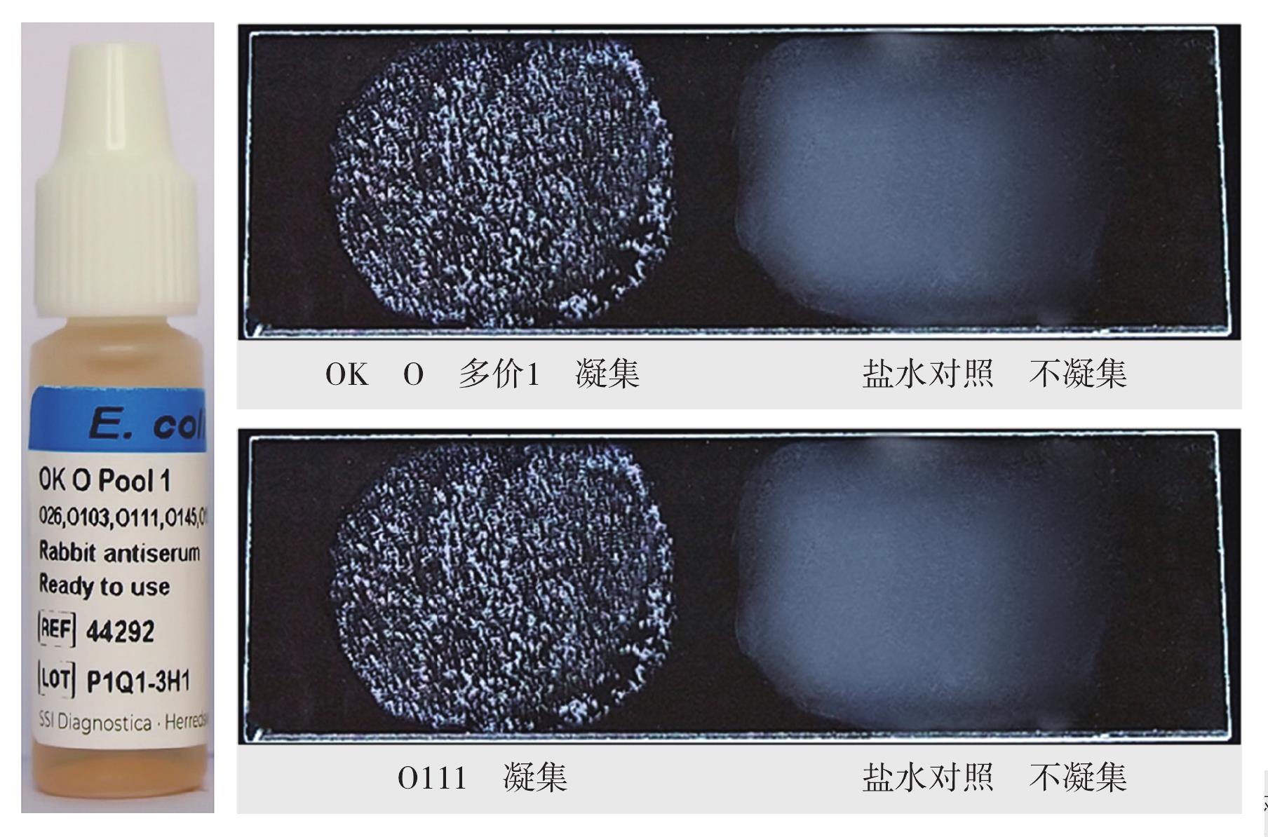 腸致病性大腸埃希菌O111血清學(xué)鑒定