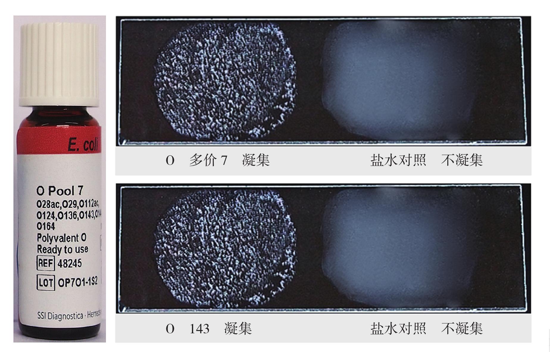 腸侵襲性大腸埃希菌O143血清學(xué)鑒定