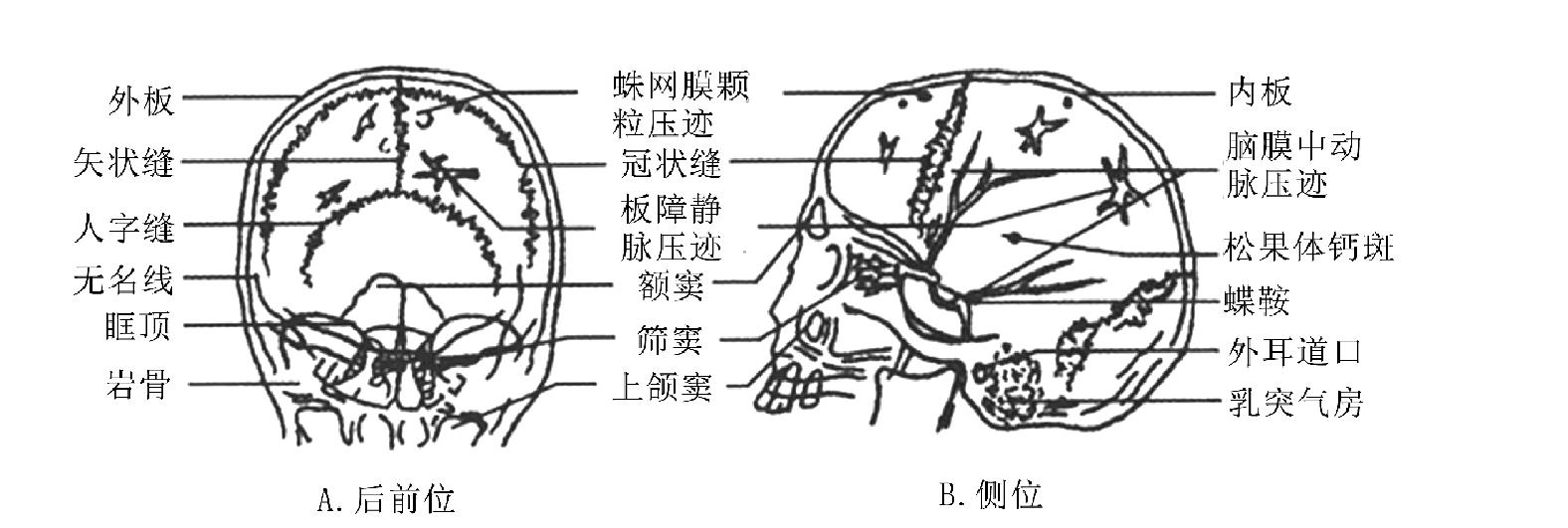 (一)頭顱平片