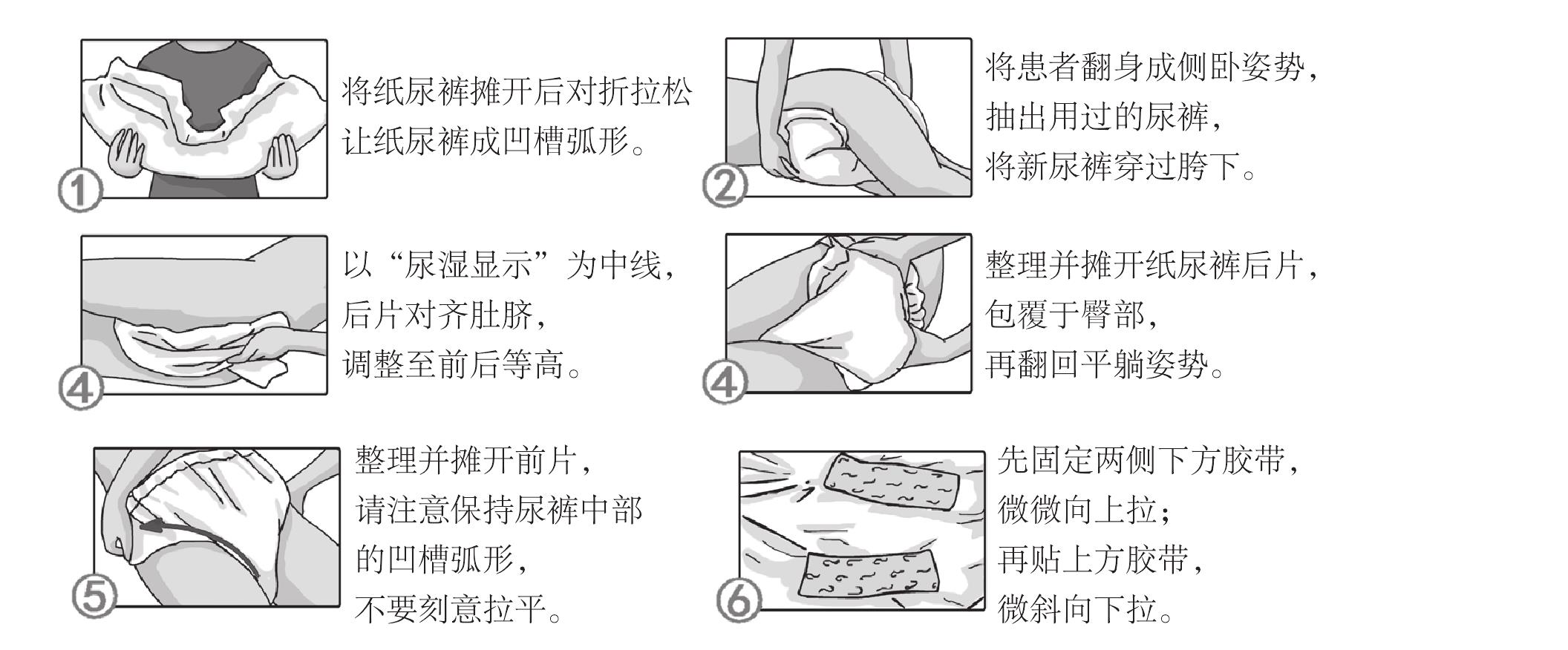 (一)排尿的照護(hù)