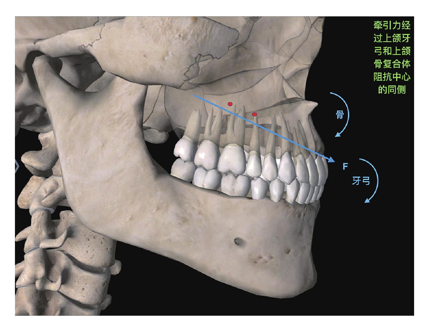 一、上颌骨复合体与上颌牙弓阻力中心位置、矫形力牵引方向的关系