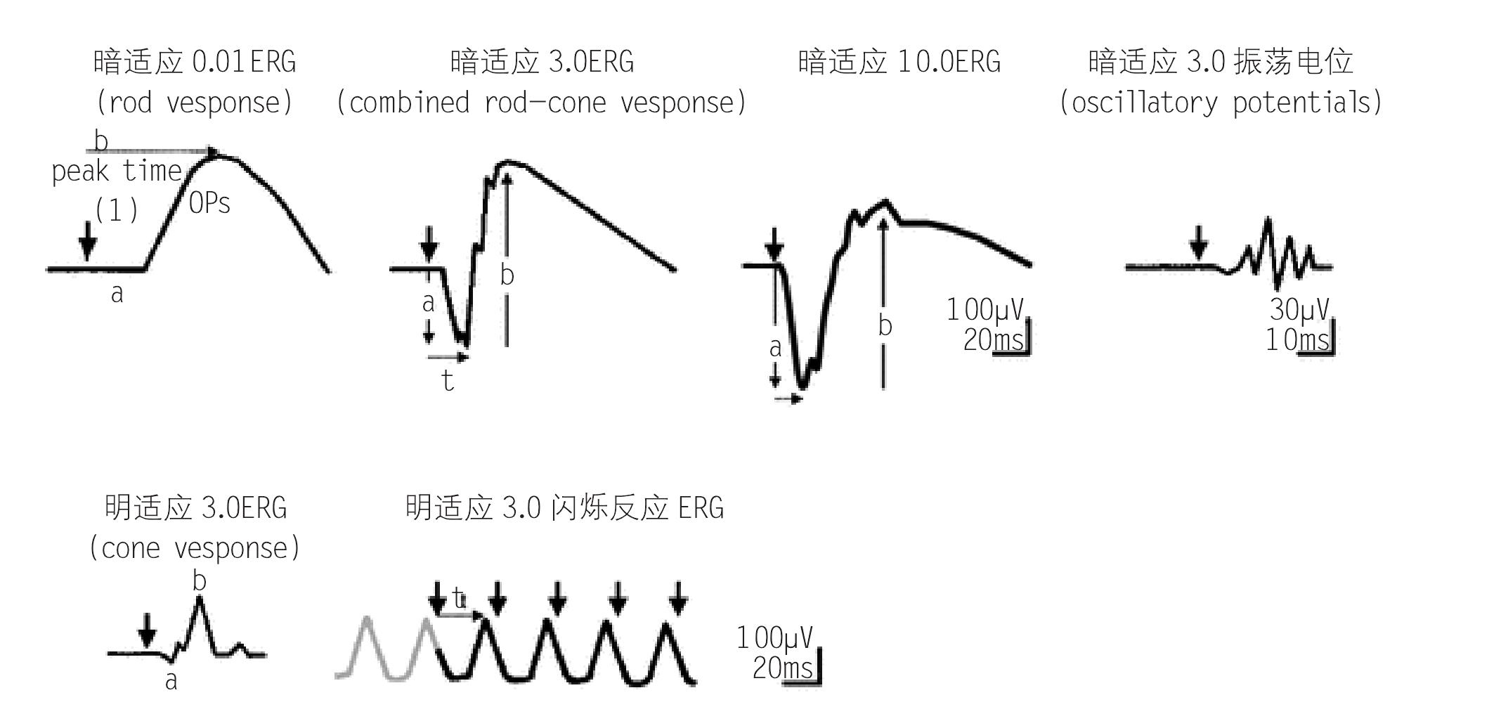 第三節(jié) 視網(wǎng)膜電圖(ERG)