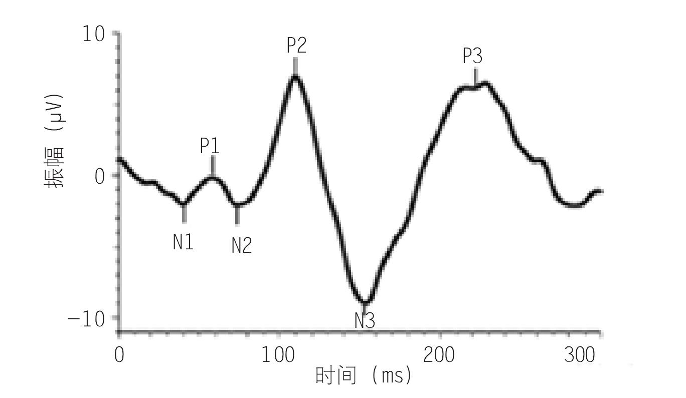 第四節(jié) 視覺誘發(fā)電位(VEP)